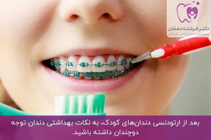 دستورالعمل‌های بعد از ارتودنسی دندان‌های کودک