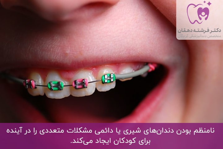 خطرات دندان‌های نامنظم برای کودکان