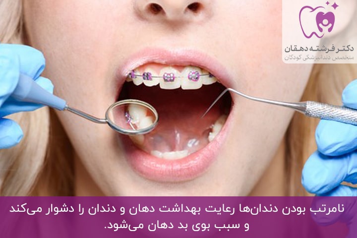 ضرورت ارتودنسی دندان کودک