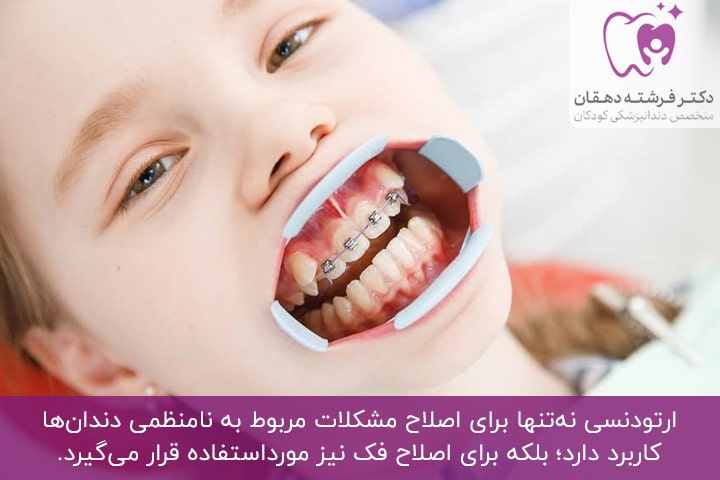 انواع روش‌های ارتودنسی دندان کودکان