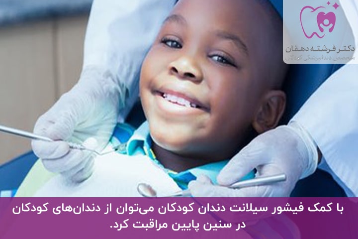 ‌اهمیت فیشور‌ سیلانت‌‌ دندان‌ کودکان