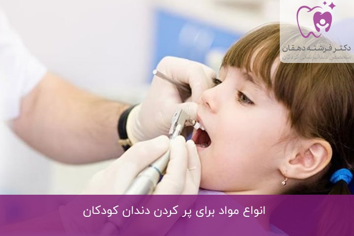 انواع مواد برای پر کردن دندان کودکان