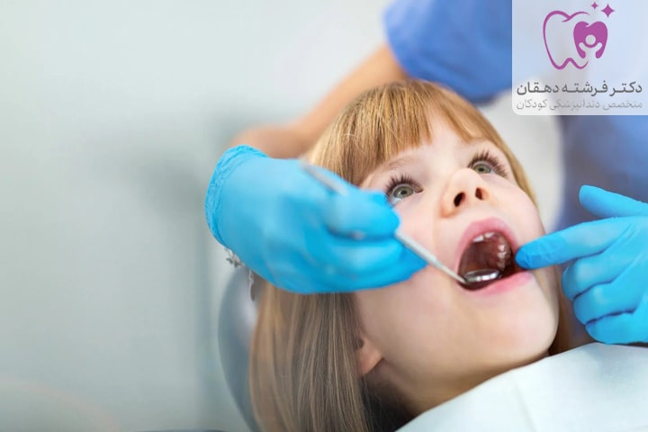 کشیدن دندان کودک با بیهوشی و مراقبت بعد از عمل
